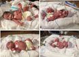NEWS: Arizona woman dies after giving birth to quadruplets