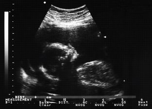 PORTLAOISE: 30 baby deaths to be investigated by the HSE