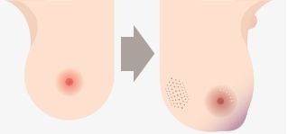 Cancer: These Early Warning Signs Could Save Your Life