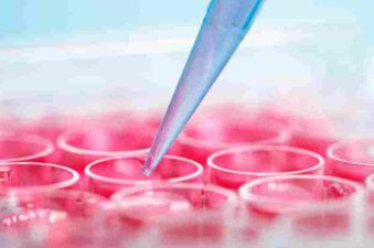 Breakthrough discovery for Alzheimer’s and Multiple Sclerosis at Trinity Collage lab