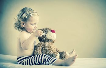 10 times I wanted to run away during chickenpox