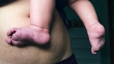 New mums post belly pics to show how AMAZING the female body is