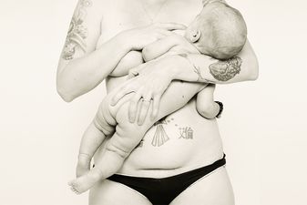 4th trimester bodies project: Beautiful birth stories   – stretches, scars and all