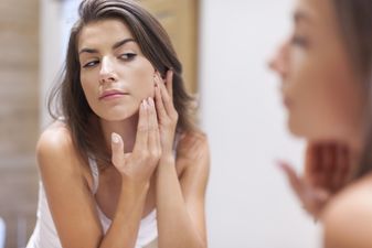 7 natural ways to help banish those pesky blemishes