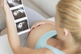 Pregnant women are using two things to figure out the sex of their baby early