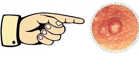 Hilarious #FreeTheNipple campaign calls out sexist social media rules