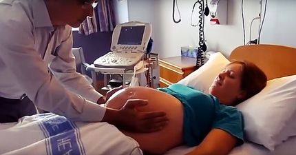 WATCH: The Moment A Breech Baby Is Turned Around