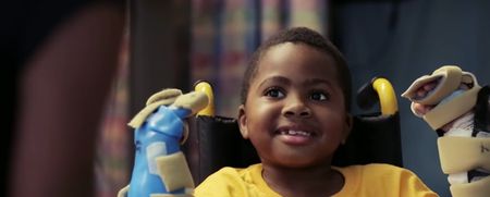 This little boy is the youngest patient to receive a double hand transplant