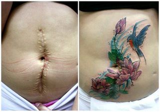 PICS: This tattoo artist turns 6 women’s scarred bodies into artworks
