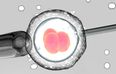 GROUNDBREAKING new study says embryos are just as effective frozen as fresh