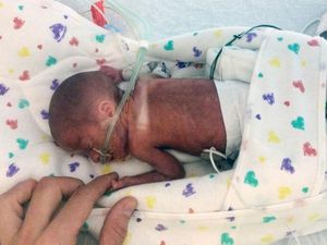 “Miracle baby” born four months early on board a cruise ship survives