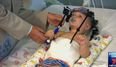Doctors reattach toddler’s head after car crash