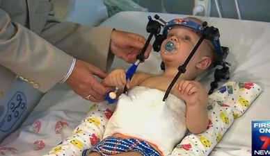Doctors reattach toddler’s head after car crash