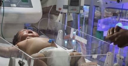 Indian woman gives birth to “miracle” baby weighing 14.77 pounds