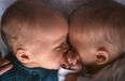 These factors might make you more likely to have twins