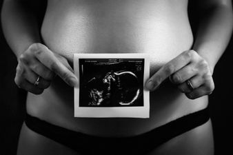 Ever heard of the ‘nub theory’? It claims to reveal your baby’s sex at 12 weeks