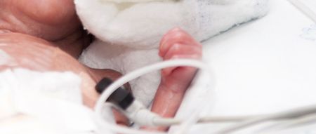 Conjoined Twins ‘Unlikely To Survive’