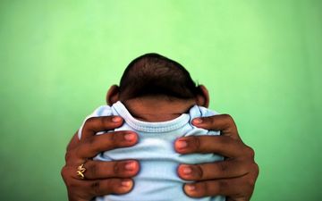 Zika Brain Damage ‘Worse Than Reported’, Says Neurologist