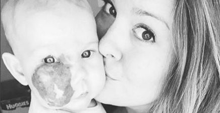“It’s A Part Of Her Unique Beauty” – Mum Hits Back At Insensitive Comments About Baby’s Birthmark