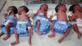 Mum Gives Birth to Surprise Quintuplets