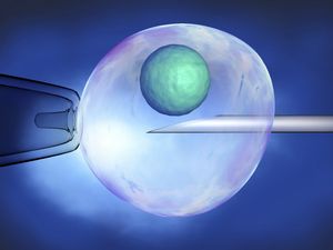 3 Families Sue Sperm Bank For Lying About Donor’s Medical Background