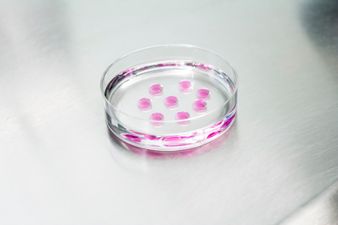 An expert has shared some of the top causes of infertility in women