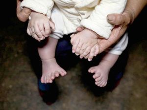 Parents Seek Help for Baby Born With 15 Fingers and 16 Toes