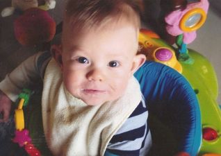 This is what happens when tongue and lip tie goes undiagnosed