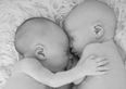 Conjoined Twins Who Beat The Odds Start School This Week