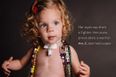 Beautiful Photo Series Shows Kids Proudly Showing Off Their Scars
