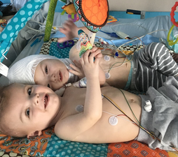 Video: Twin Boys Once Conjoined Cuddle Face To Face For The First Time