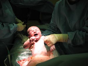 This hospital has the highest rate of Caesarean section births in Ireland