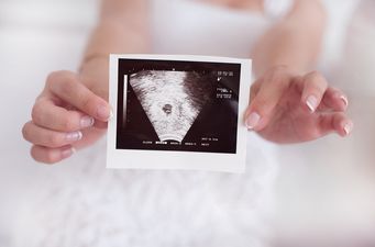 The surprising thing you can now spot in your baby’s scan (and it affects them for life!)