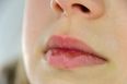 This very simple beauty hack will FINALLY heal your dry chapped lips
