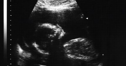 A full maternity services complaints review is to be published by the HSE