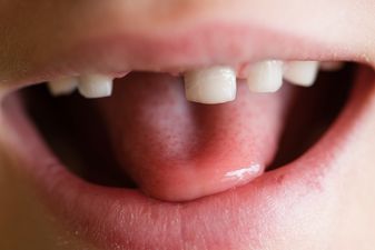 Mind the gap: Photographer ‘enhances’ child’s school picture