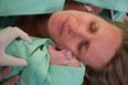 Mums who breastfeed after C-section are less likely to experience pain
