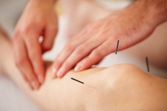 World’s largest trial finds acupuncture as effective as pain medicine