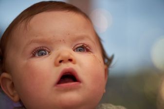 Doctors warn that children with conjunctivitis are being treated incorrectly