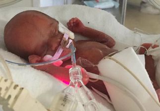‘Miracle’ baby Poppy who weighed just 300g at birth finally goes home