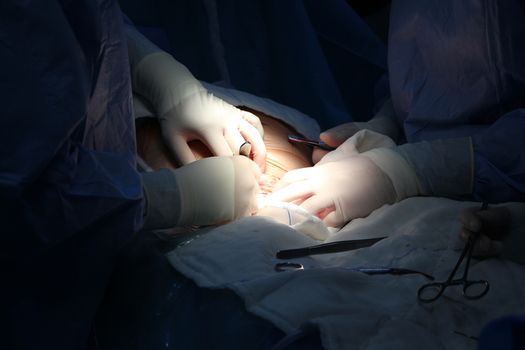 Baby born heart surgery in the womb