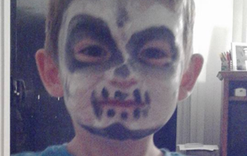 Mum shares warning about face paint that ‘severely burnt’ her son’s skin