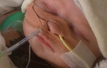 This eight-week-old baby got a new heart just in time for Christmas