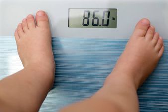 Obese children likely to die 20 years before healthy children