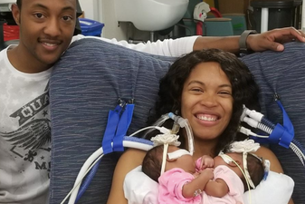 Mum pays heartbreaking tribute to her conjoined baby girls who passed away