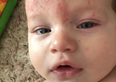 Mum says €8 body lotion ‘transformed’ her baby’s eczema