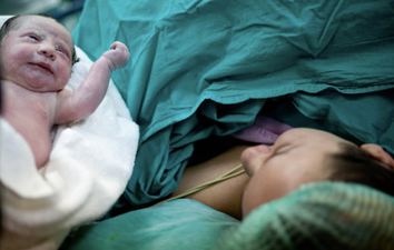 C-section and induction rates increasing for first-time mums in Ireland