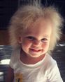 This adorable little girl has extremely rare hair and it’s absolutely amazing