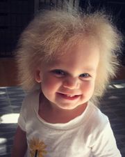 This adorable little girl has extremely rare hair and it’s absolutely amazing