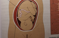 Parents’ fury as pregnancy diagram shows woman with a Brazilian wax